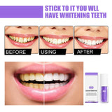 🦷 2x Whitening Toothpaste – Advanced Stain Removal for a Brighter Smile